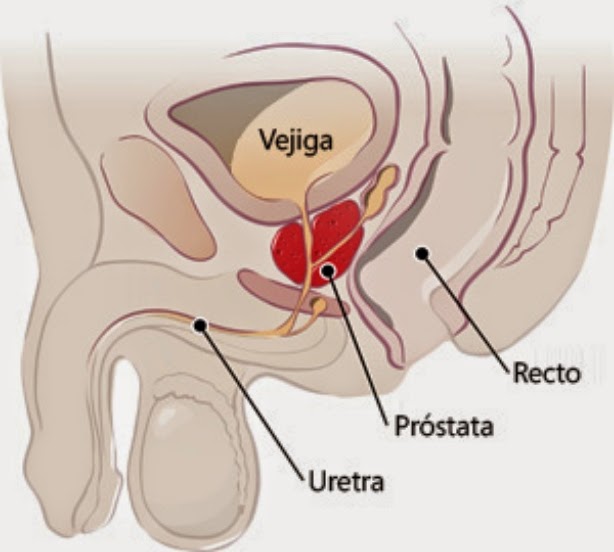 prostata congestionata cause