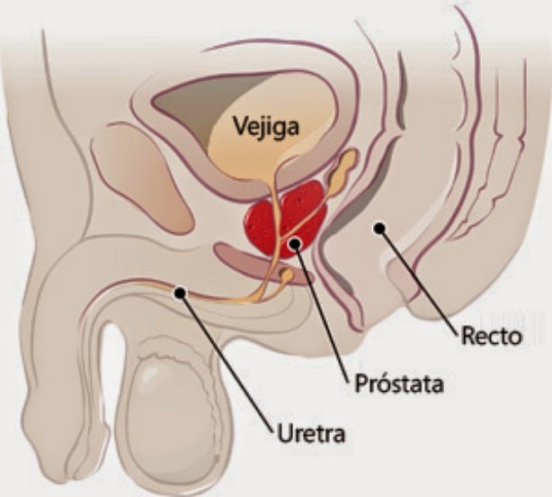 prostatita cu vitaprinol