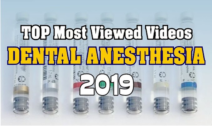 DENTAL ANESTHESIA: TOP Most Viewed Videos - 2019