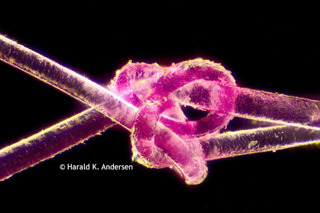 Hair captured under the microscope.