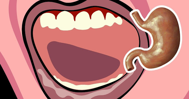 Myths about bad breath make the breath smell bad forever Bad breath comes from the stomach