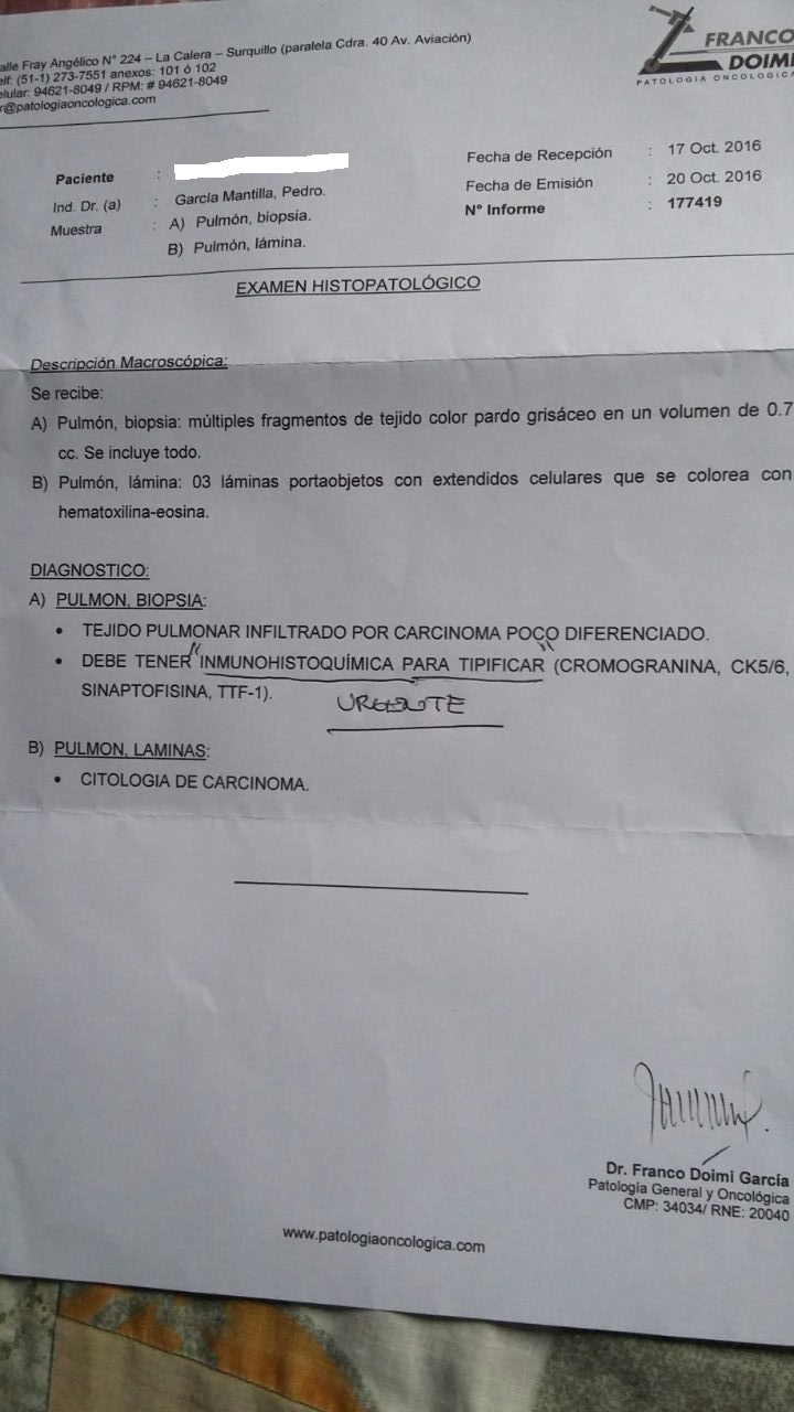 MÉDICO Dr. Carlos Gibaja CÁNCER PULMONAR