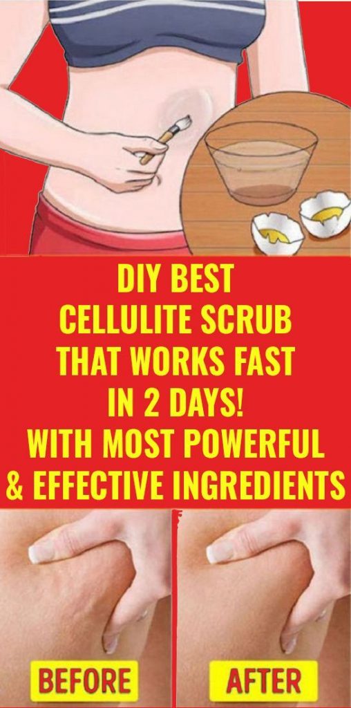 DIY BEST CELLULITE SCRUB THAT WORK FAST IN 2 DAYS! WITH MOST POWERFUL