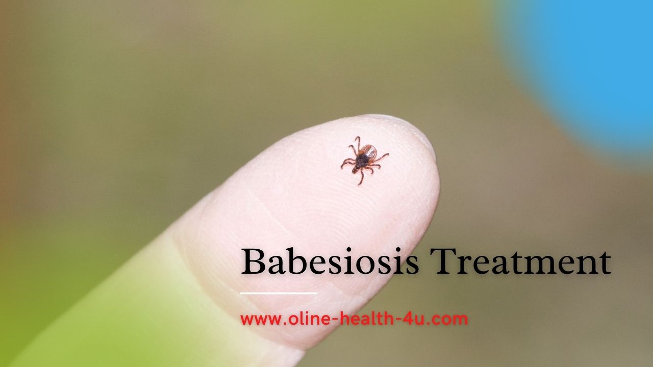 what-is-babesiosis-causes-and-signs-of-babesiosis