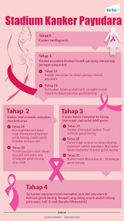 cara mudah mengobati kanker payudara paling ampuh