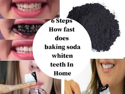 How To Teeth Whitening Naturally - Keep your Teeth fresh Whiten Tips