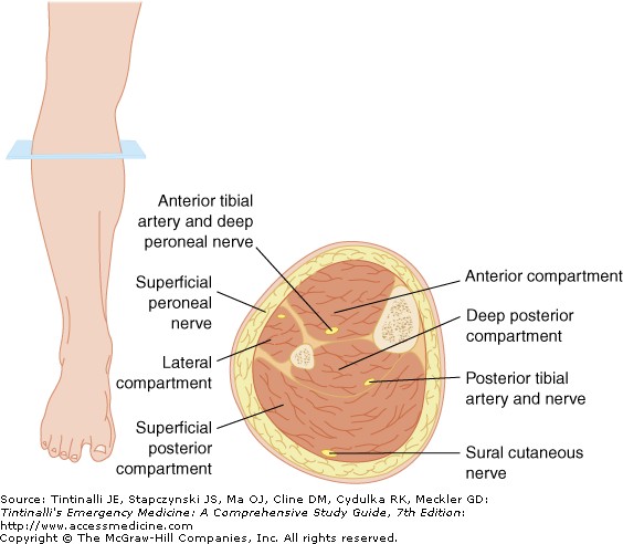 Petani Kendeng Semen Kaki, Tahukah Bahwa Akibatnya Bisa Seperti Ini? Petani Kendeng Semen Kaki, Tahukah Bahwa Akibatnya Bisa Seperti Ini?
