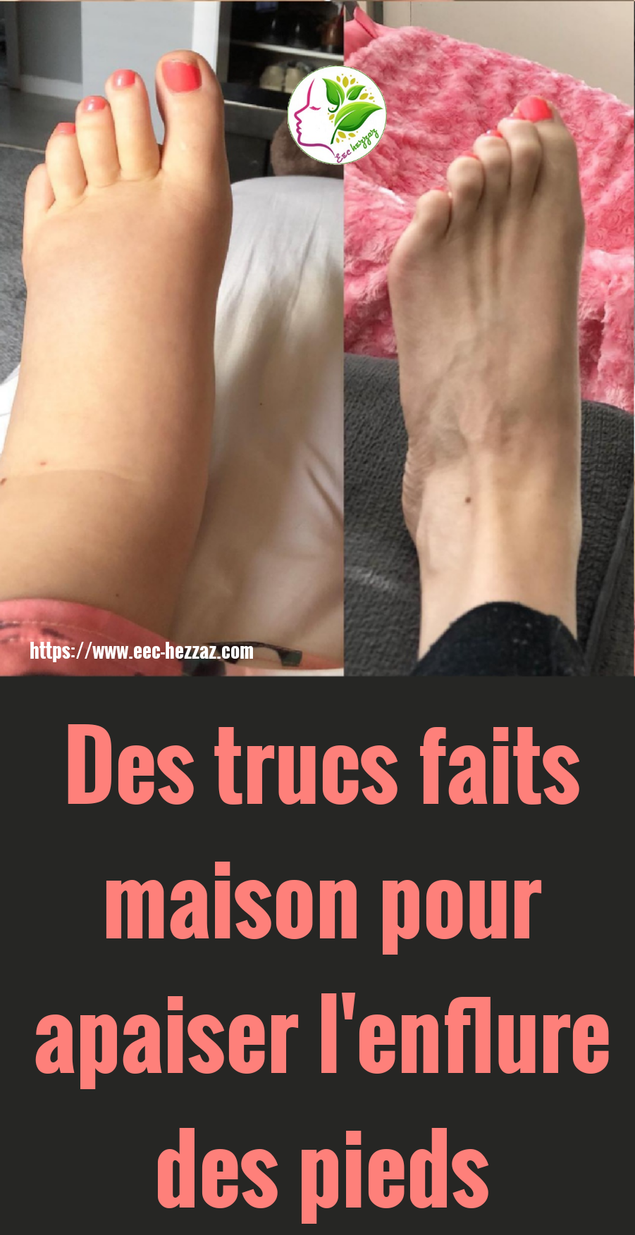 Des trucs faits maison pour apaiser l'enflure des pieds