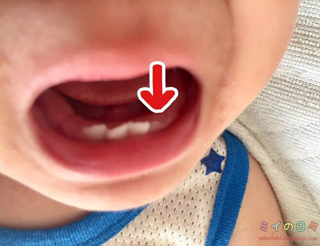歯 赤ちゃん こんにち歯 下の歯 遅い 1歳6ヶ月
