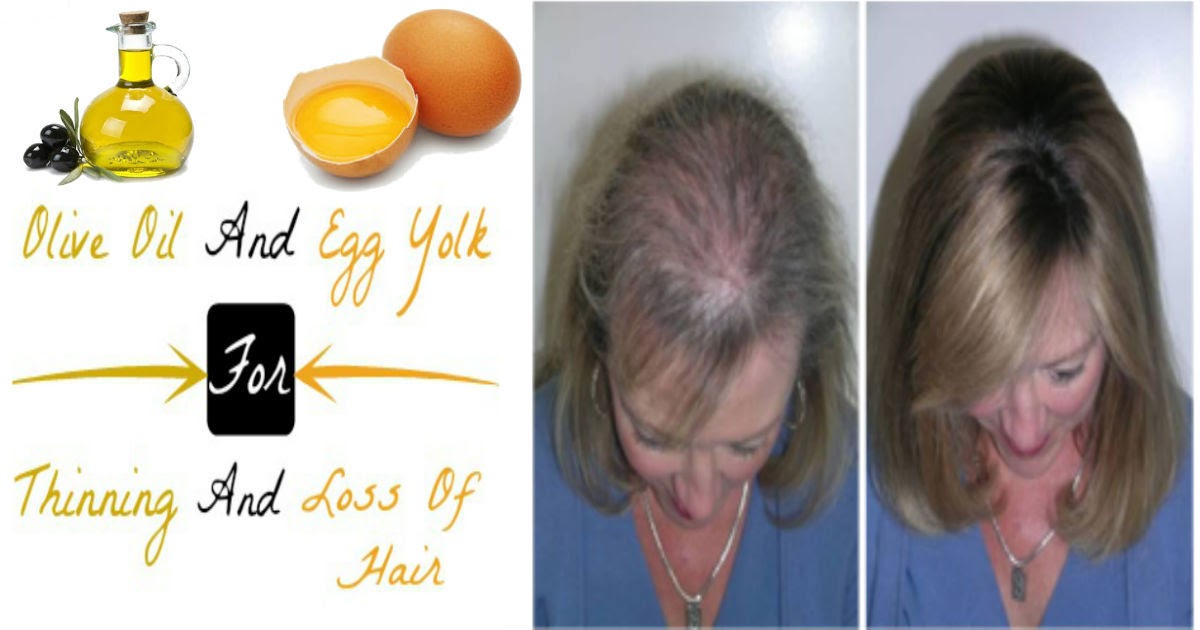 Olive Oil and Egg Yolk For Thinning and Loss Of Hair Home Remedies