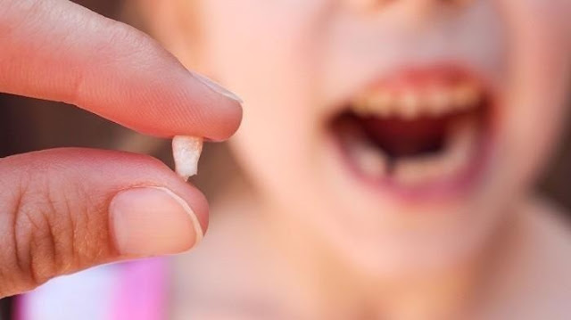 16 Arti Mimpi Gigi Copot Menurut Primbon Lengkap - Primbonku - Segala Arti  Mimpi Ada Disini!!