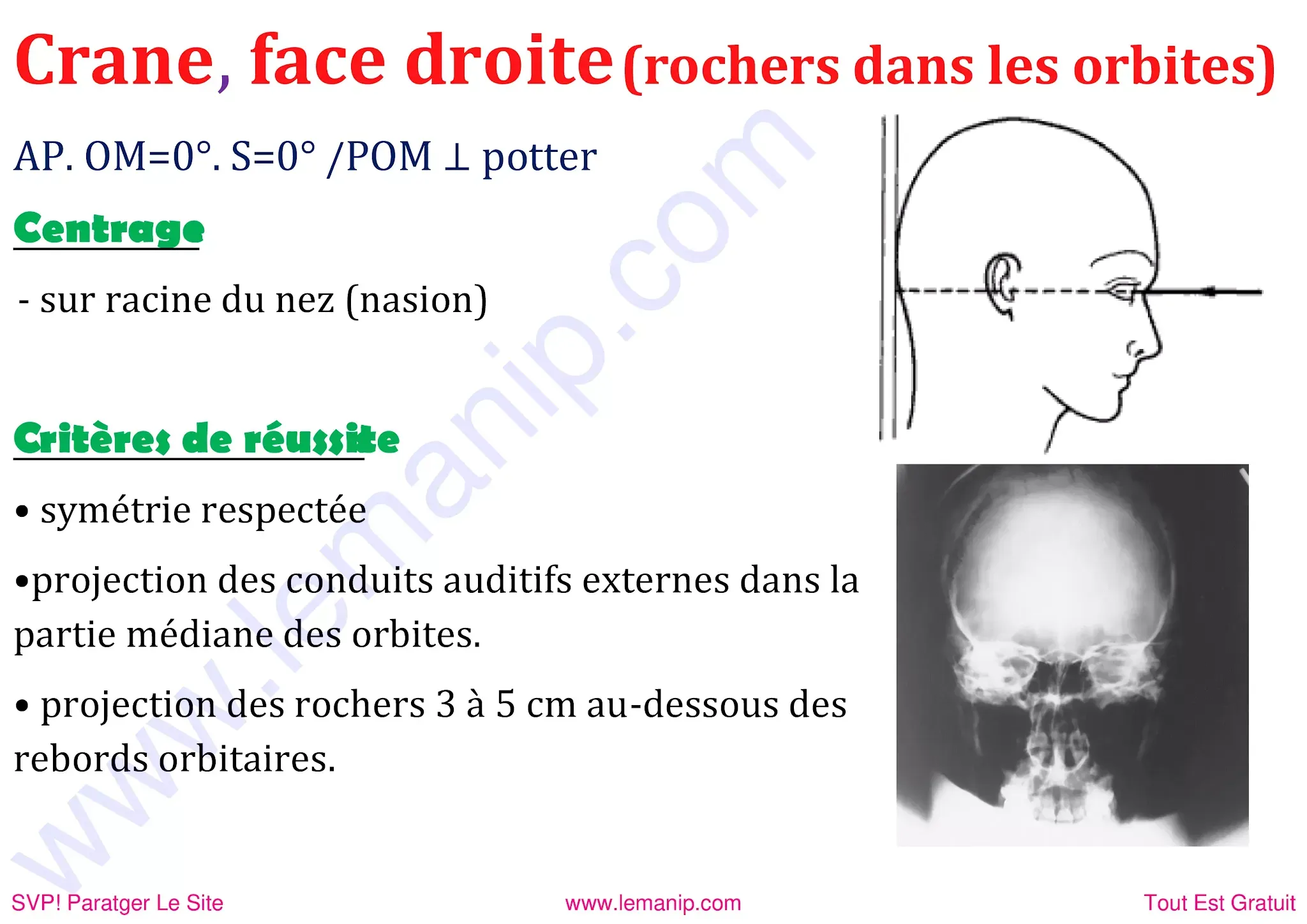 Crane face droite