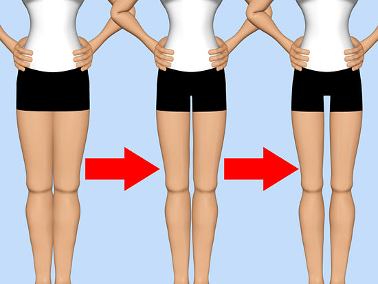 Thigh gap: η επικίνδυνη δίαιτα που εξαπλώνεται σε ΗΠΑ και Γαλλία