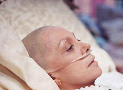Penyebab Kanker Yang Sering Kita Tidak Ketahui