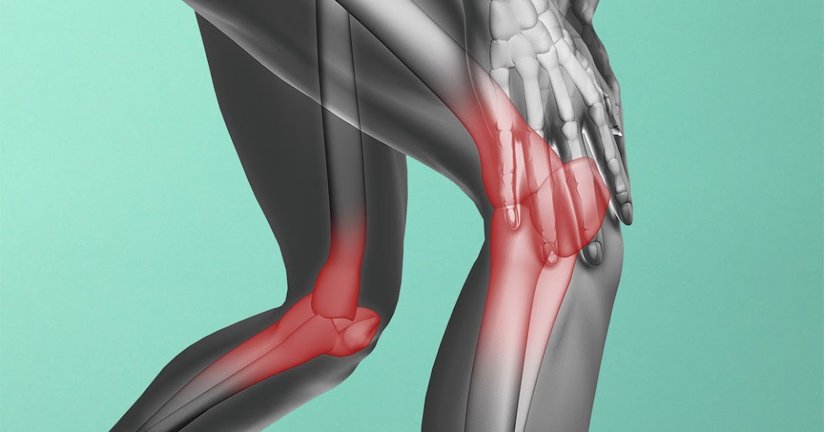 Arthritis Help 4 Friends What Does Arthritis Feel Like? Plus, the 7