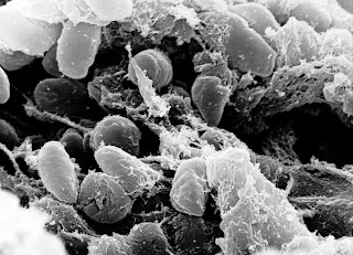 Veba hastalığına neden olan bakteriler (Yersinia pestis)