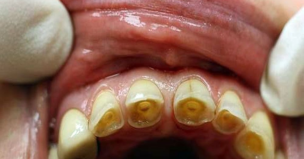 oral pathology oral pathology