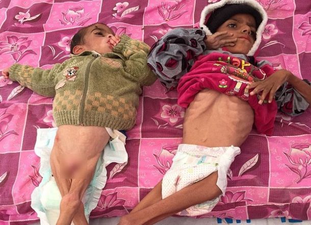 Potret Pilu, Bocah Jajahan ISIS yang Menjemput Maut Secara Perlahan-lahan Potret Pilu, Bocah Jajahan ISIS yang Menjemput Maut Secara Perlahan-lahan