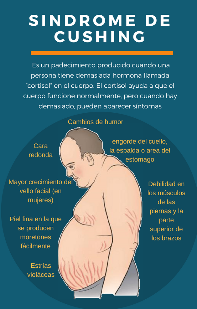 Síndrome de Cushing Síndrome de Cushing