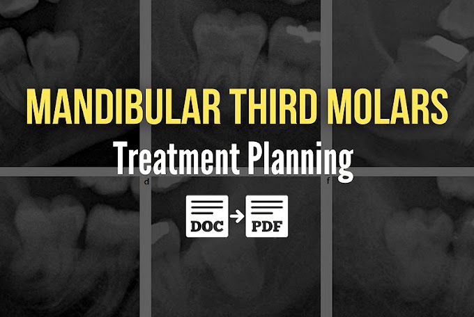 PDF: Treatment Planning for Mandibular Third Molars