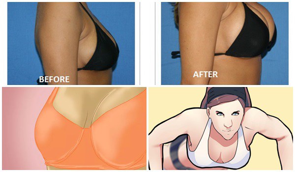 How To Lift Saggy Breast Naturally Exercises For Lifted And Sexy