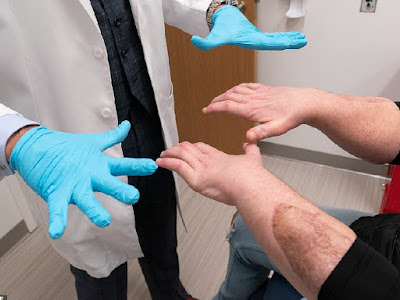 double hand face transplant double hand face transplant