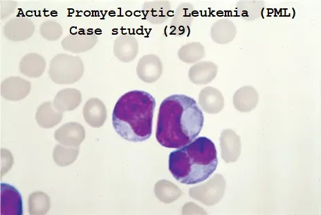 Hematology case studies with answers pdf image