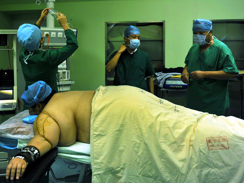 My Little World Akibat Terlalu Banyak Minum Soda