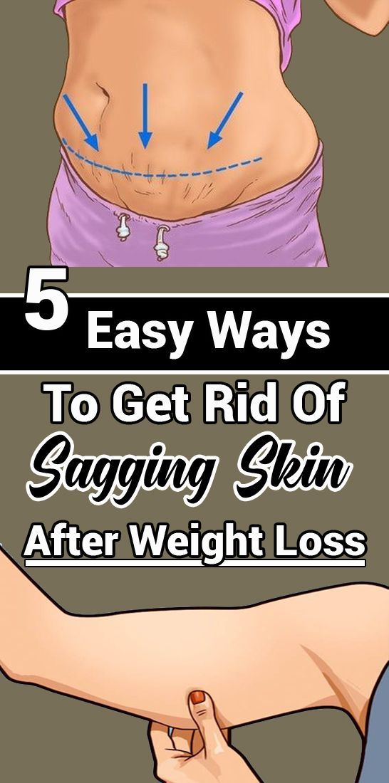 5 Easy Ways To Get Rid Of Sagging Skin After Weight Loss Sweet Oh Joy