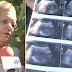 70-Year-Old Who Claims She Is PREGNANT Will Become World's Oldest Woman To Give Birth If It Proves True