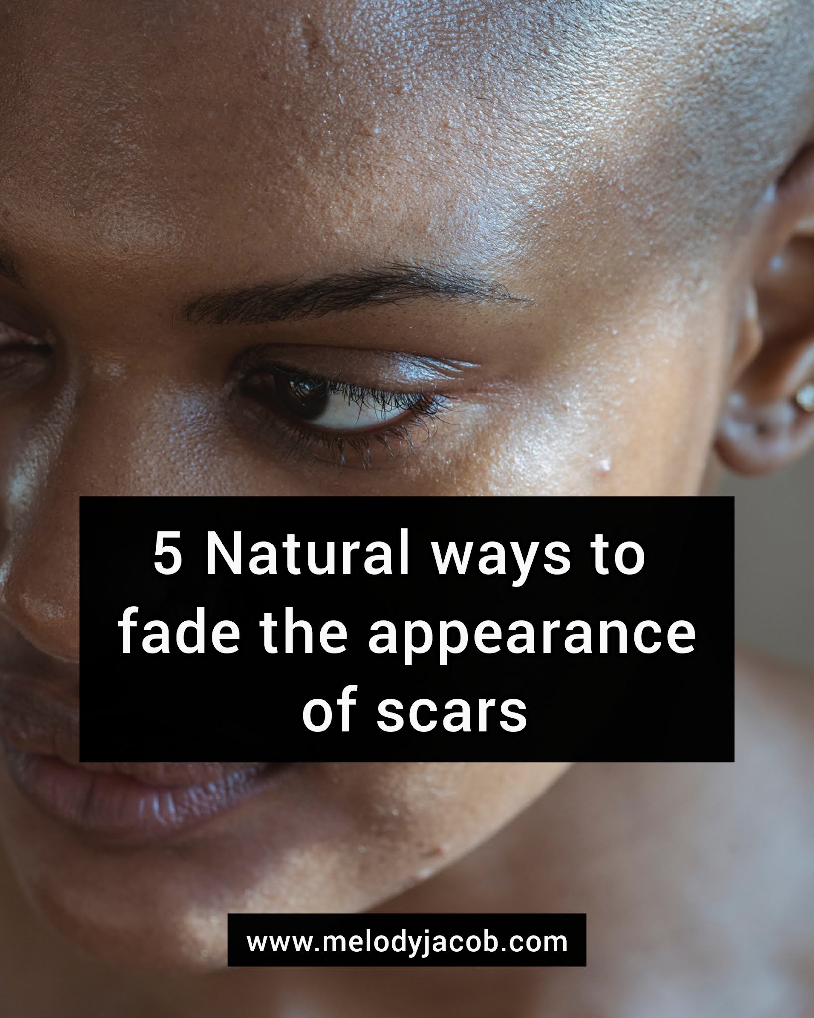 Natural Ways To Fade the Appearance of Scars Melody Jacob