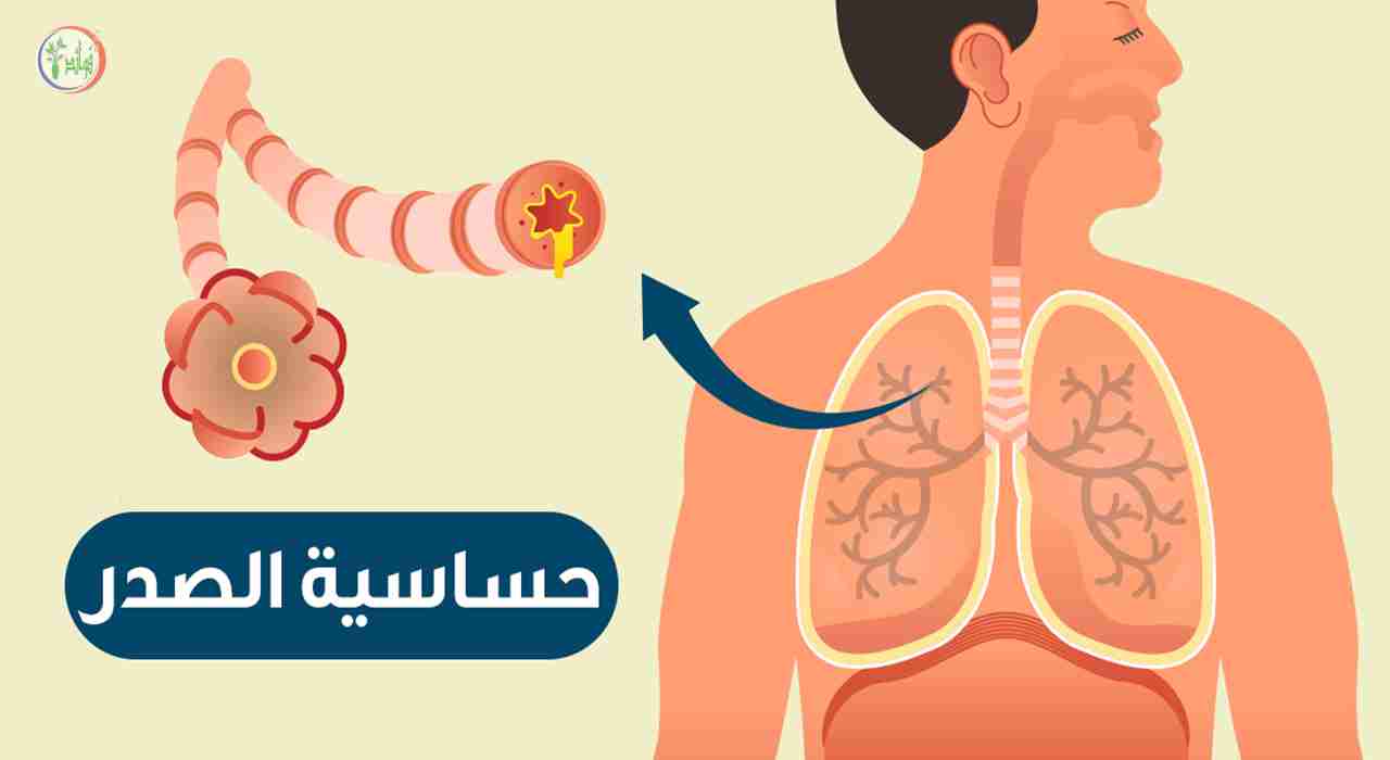 الإملاء الحريق صاحب متجر علاج الحساسية الصدرية بالقرنفل Alterazioni Org