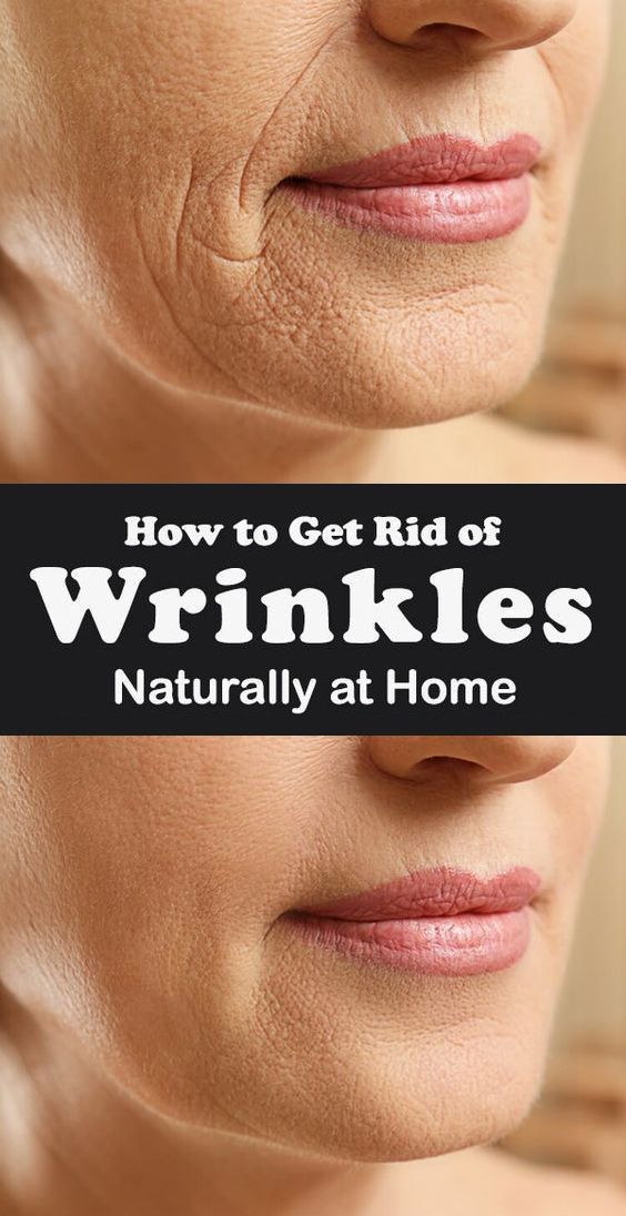 wrinkle forehead predieva
