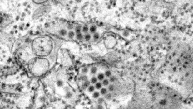 Virus dengue Virus dengue
