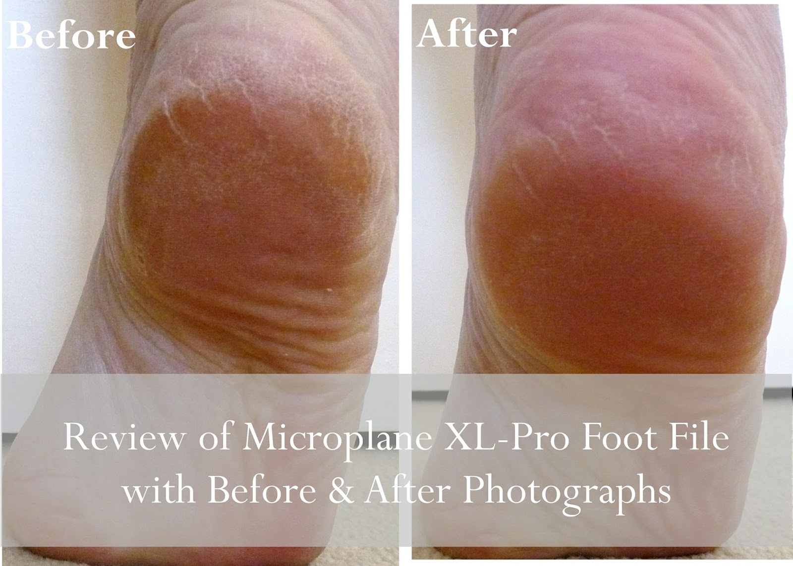 Microplane foot file Dips Delectus: From Terrible Trotters to Terrific Tootsies - A Review