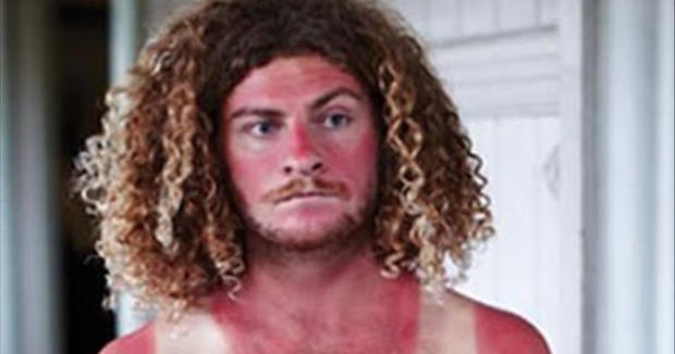 L² Evolution: Fugly Singlet-line Sunburn