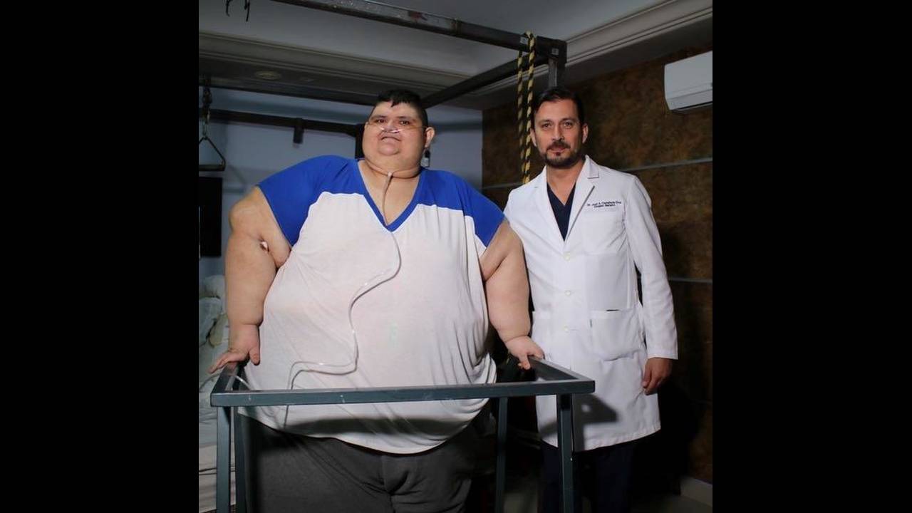 Мужчина с большим весом. Хуан Педро самый толстый человек в мире.
