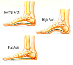 Primary Health Station: Heel Pain When You Step: Likely Plantar Fasciitis