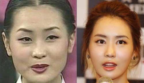 Korean Actress Lee Da Hae Admits To Plastic Surger ~ All Pop News