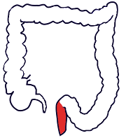 Rectum (dubur) Rectum (dubur)