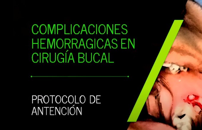 WEBINAR: Complicaciones hemorrágicas en Cirugía Bucal - Dr. Braulio López