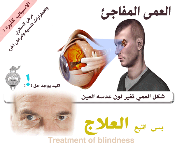 خدمات السفراني Alsafrani العمى المفاجئ بسبب مرض السكري ونبحث عن الحل Treatment Of Blindness