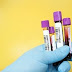 New York survey suggests nearly 14% in state may have coronavirus antibodies