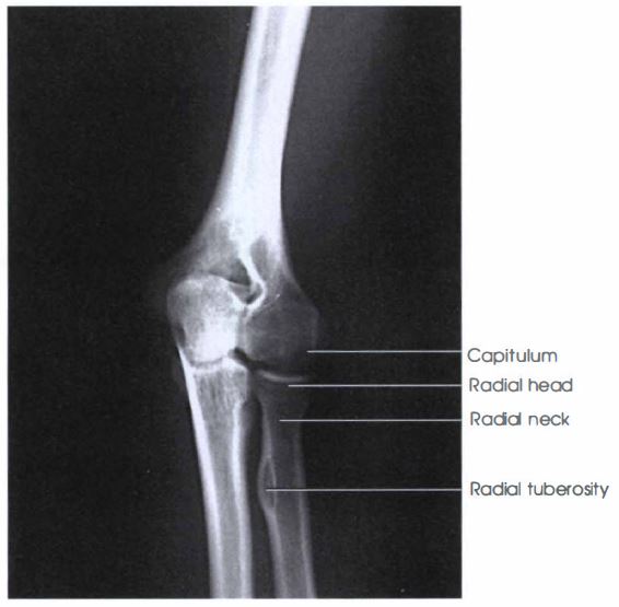 External Oblique Elbow X Ray