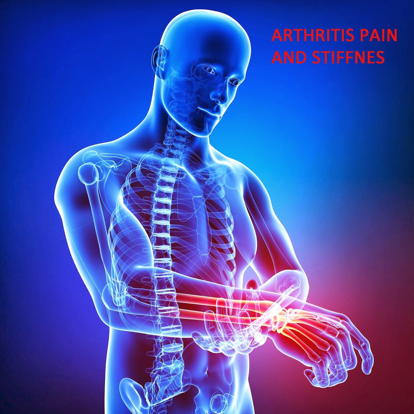 MYO Therapy & Healthcare Institute Exercise helps ease arthritis pain and stiffness