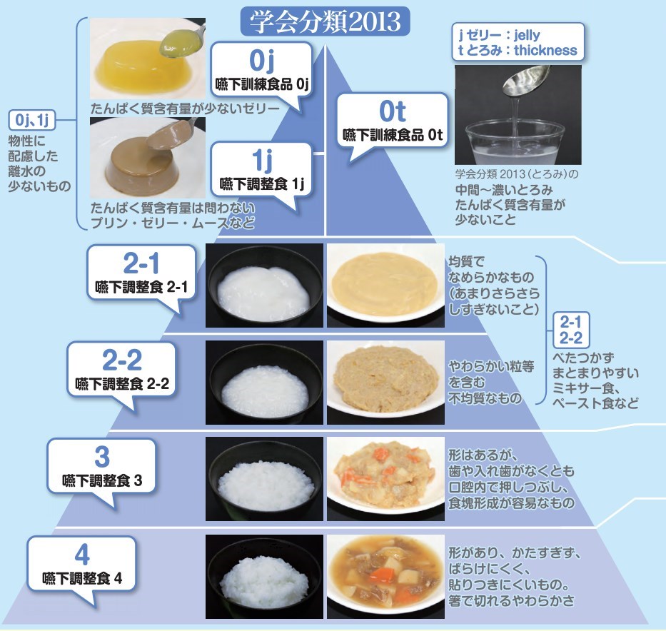 食 分類 調整 2013 嚥下 トピックス