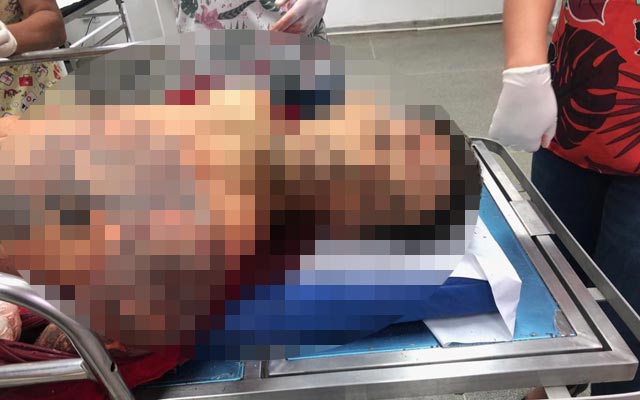 Criminoso atira em policiais militares e morre durante confronto em São José