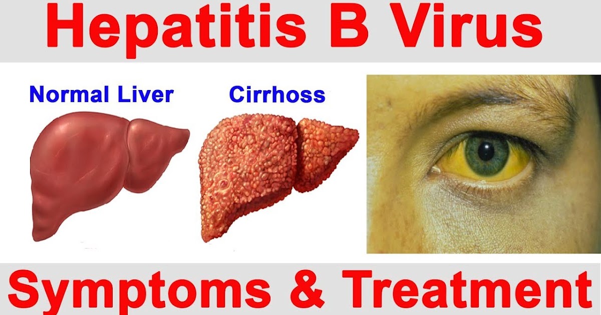 Rapid STD Testing Hepatitis B Causes, Symptoms and Treatment
