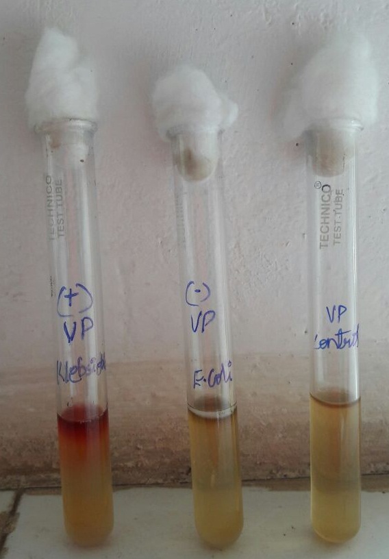 SENTHIL PRABHU SIVASAMY Voges Proskauer (VP) Test (Non acid end product test)