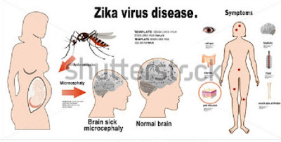 penularan virus zika